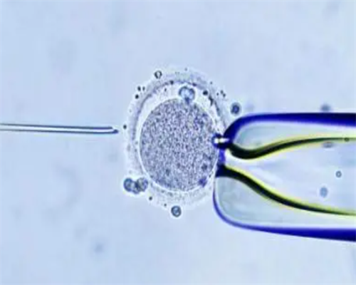 代妈试管生子基础费用?,代妈红房子医院曹玲仙大夫做试管婴儿的成功率高吗？