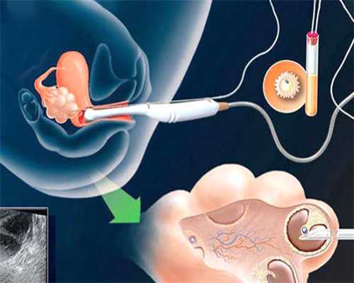 深圳现代生物科技业务,为什么取卵个数这么少 北京试管婴儿哪个医院好-试管婴