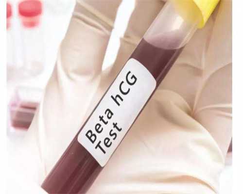 四川代妈招聘多少钱|鄂州供卵公司多少钱（北京代妈最高报酬多少）-四维彩超