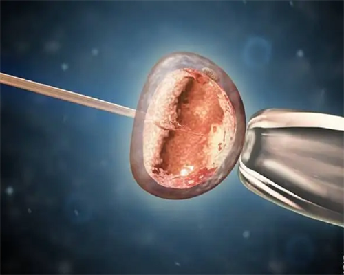 代怀代生包男孩,做试管婴儿费用多少，国内三代试管费用分享_北京大学人民医