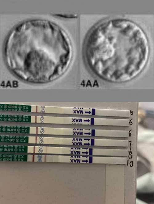 代妈供卵多少钱,代妈23岁女子**还钱！3家医院连打17天促卵针，最终不孕病危！