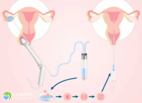 可爱男孩帅气发型指南：0-1岁宝宝的时尚造型秘籍