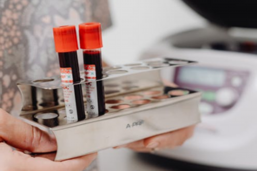 上海代生代怀,amh0.36不能自然怀孕？卵巢早衰不排卵做试管也有希望-上海供卵试