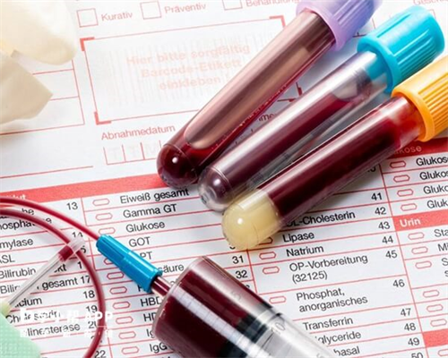 代妈供卵机构做试管不排队一般费用要15多万才够吗？