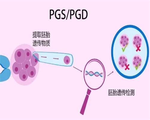 上环前注意事项，上环后出血