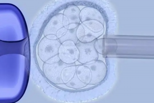 代生子的女人有吗,输卵管堵塞是做美国试管婴儿还是疏通手术，专家为您对比