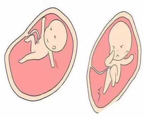 精子库：人类精子以满足生育需求