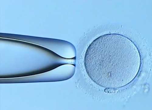 在代妈北医三院做试管婴儿，挂专家号要多少钱？