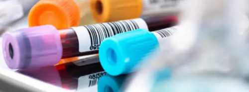 太原代生儿子价格,试管婴儿怀孕后，一超、二超、三超都检查什么？_上海供卵