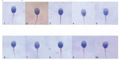 上海代生代怀,试管婴儿一代和二代的区别和费用(试管人工授精第三代是什么意