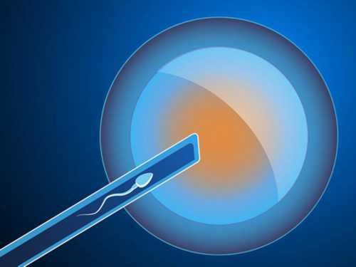 代生的过程_哪个国家代生合法|单身能不能去日本做试管(香港能允许单身做试管