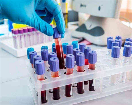 代妈试管医院有哪些？?,为什么有谣言传要紧急停用代妈科兴中维疫苗？