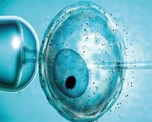 试管婴儿可以让人代生吗,做俄罗斯试管婴儿，取卵前需要注意什么？_试管移植