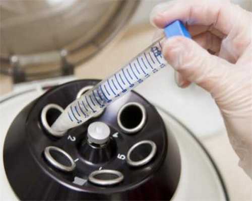 广州试管代生包男孩机构,美国试管专家科普：多囊卵巢可以选择微刺激促排方