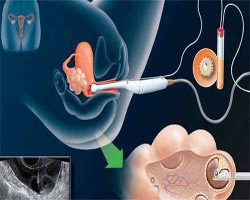 试管移植如何防止空囊？试管移植防止空囊的技巧与方法