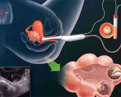青海代生女孩,失败2次,有45岁做试管婴儿移植成功的来分享一下吗?_移植后低分
