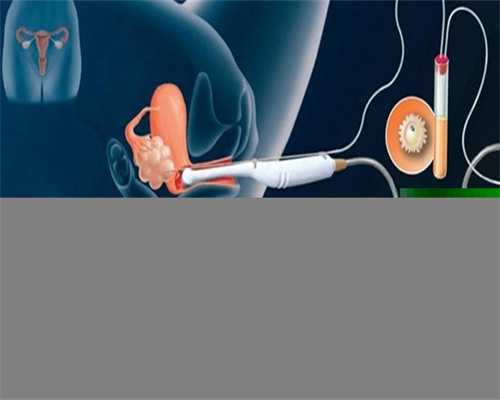 提升精子库服务质量：探讨在线平台的优势及挑战