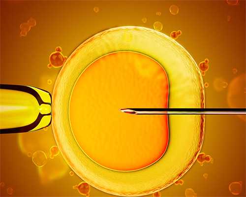 厦门代生代怀,做柬埔寨试管婴儿需要什么条件？_孕妇查查大便是检查什么_试管